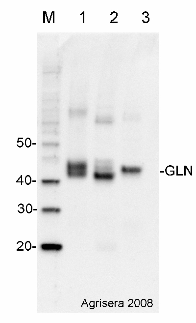 Western blot detection using GLN1 GLN2 antibodies